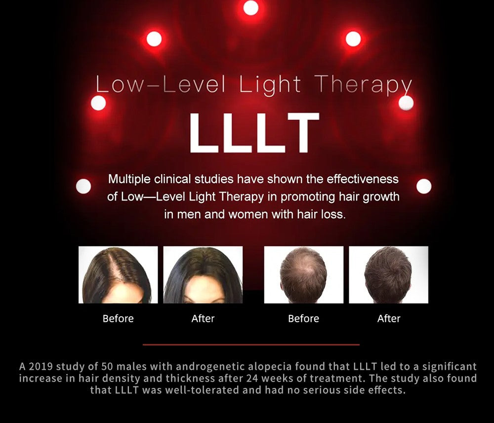 LumiFolix Pro: Laser Hair Growth Cap.