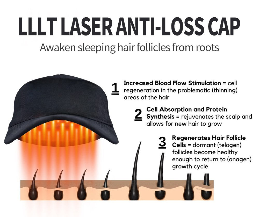 LumiFolix Pro: Laser Hair Growth Cap.